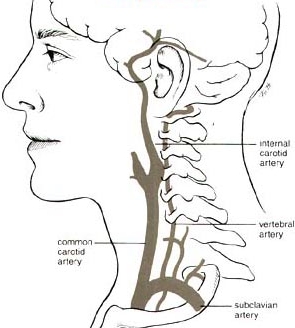 Carotid & Vertebral Artery