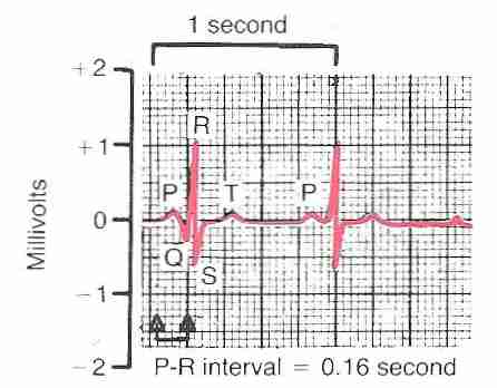 [ Normal electrocardiogram ]