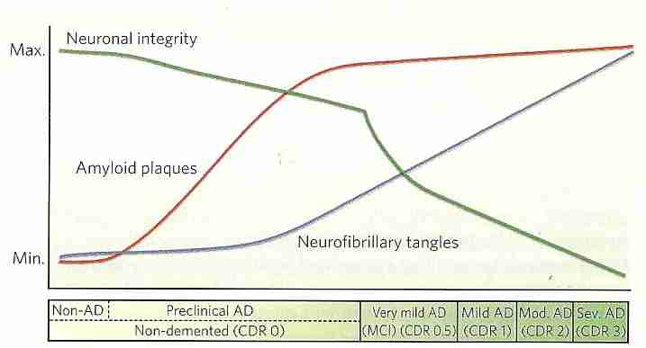 Amyloid plaques precede AD symptoms