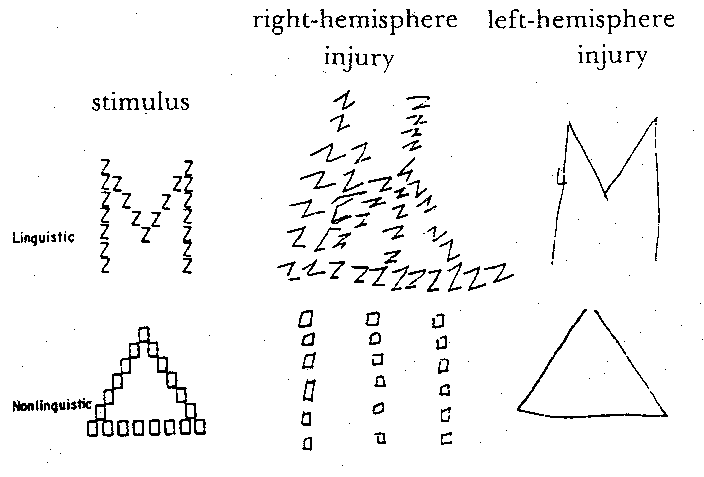 [drawings by singly cerebral-hemisphere-injured patients]